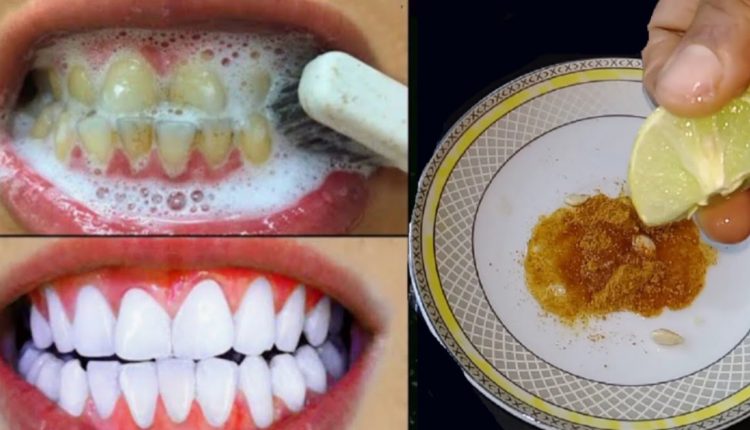 teeth-whittening-tips