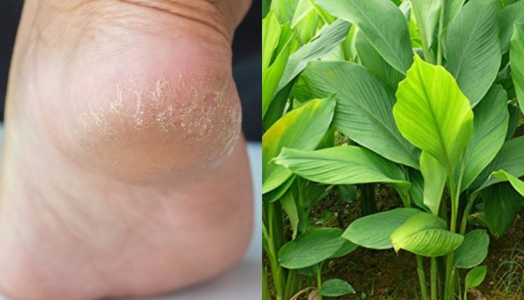 Kalile Vindu Keeral Maran Easy Tip